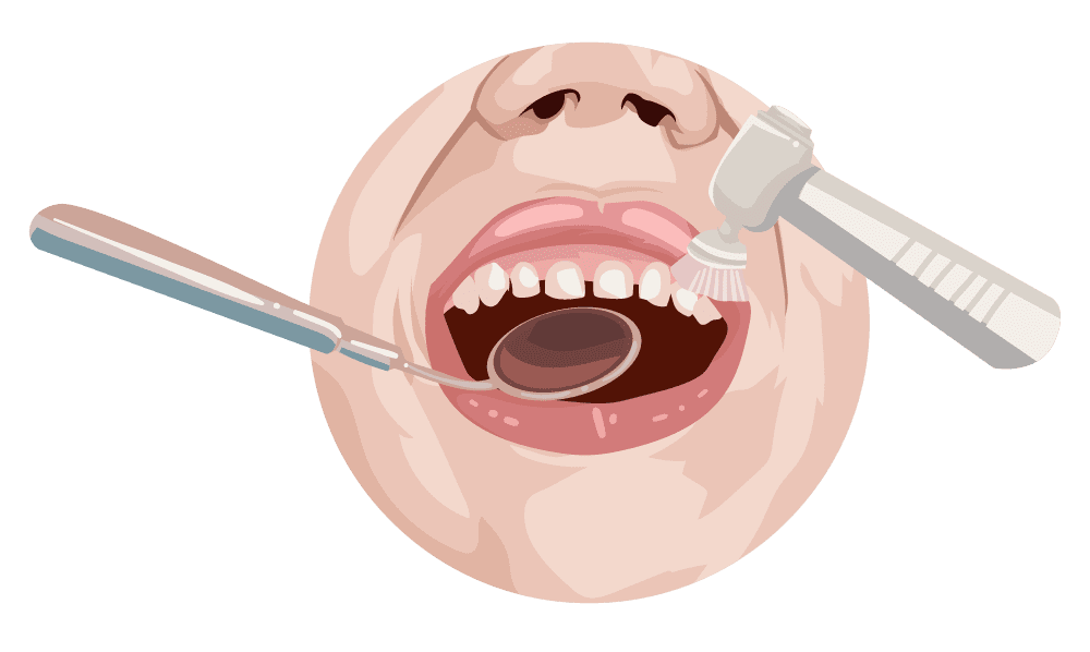 Dental-cleaning-3 Dental Cleaning Saves Money