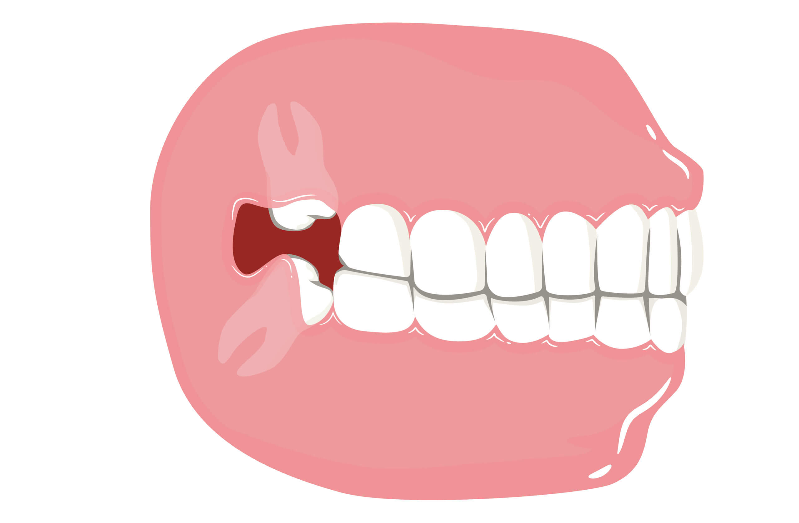 tooth bridge tmj treatment