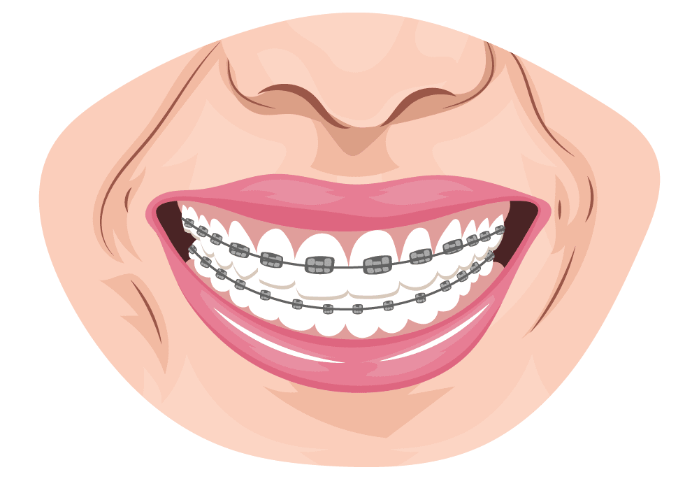 tooth extraction cost veneers