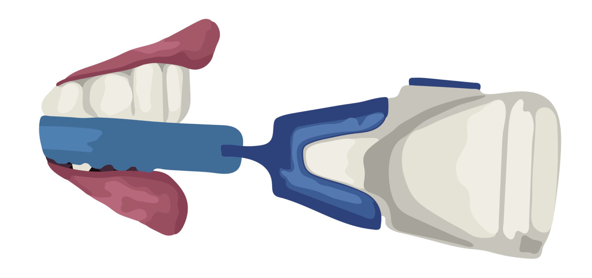 Propel orthodontics Propel orthodontist in Houston