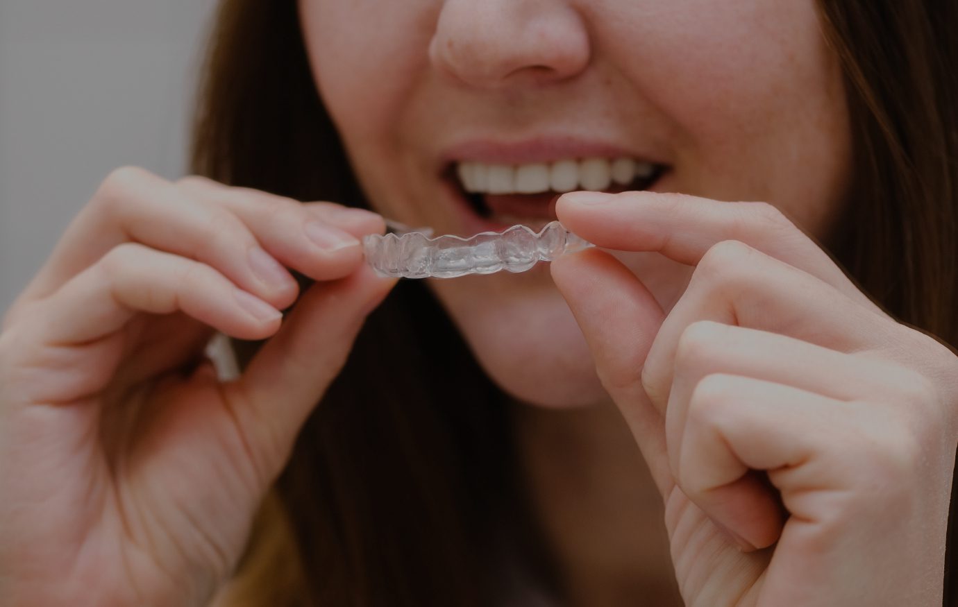 invisalign in Houston invisalign in Houston