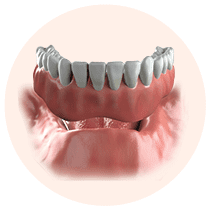 dentures